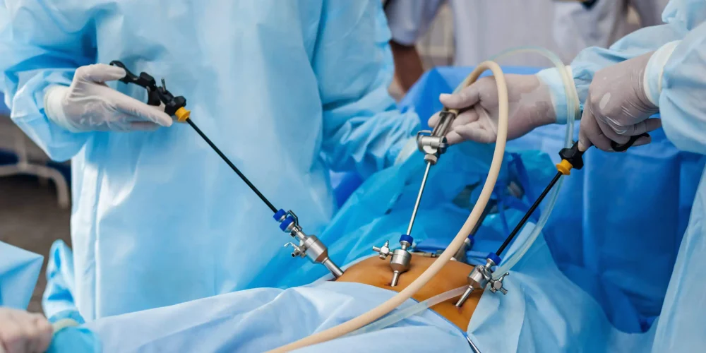 best-hospital-for-laproscopic-surgery-in-kalher1 best-hospital-for-laproscopic-surgery-in-kalher1